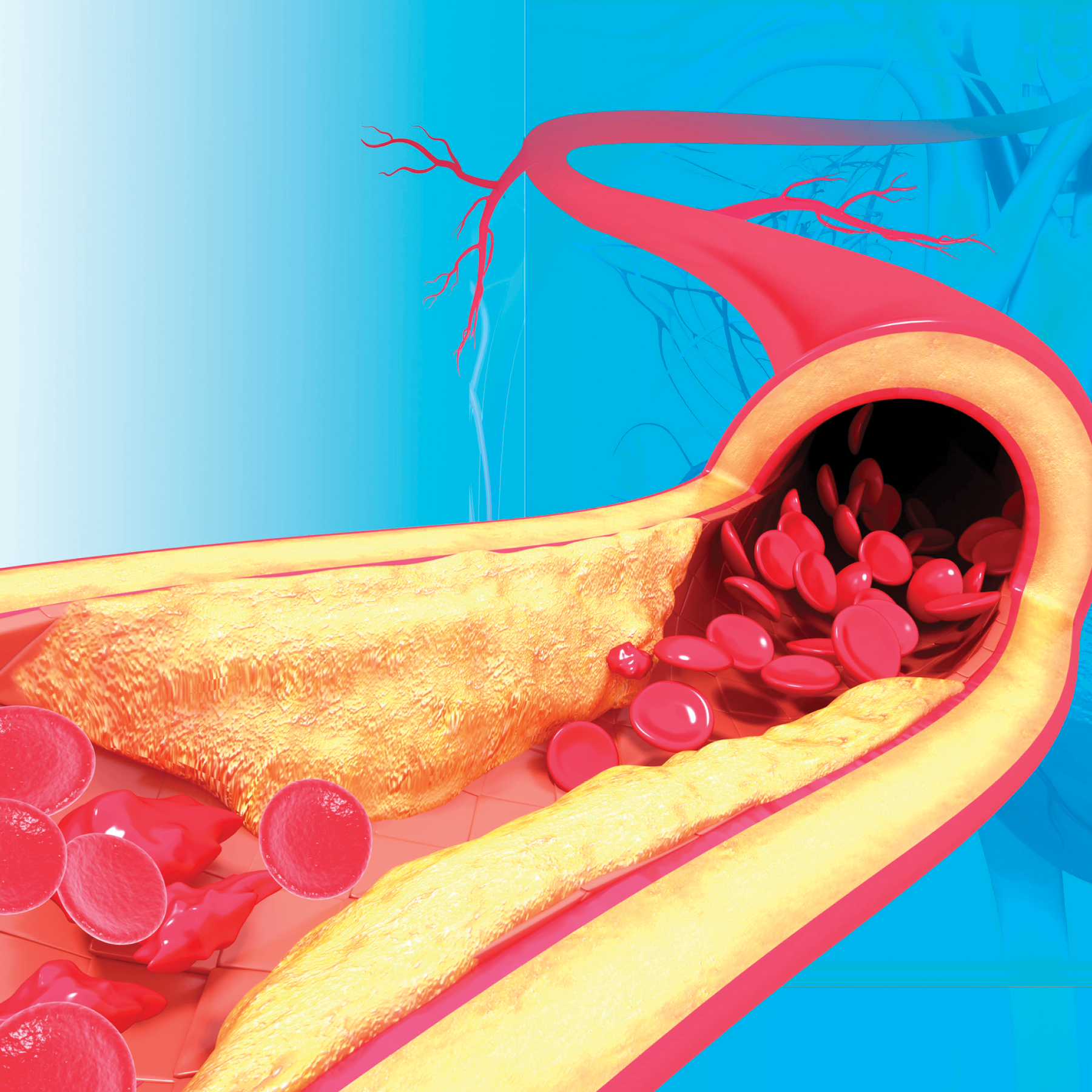 ON DEMAND Yale Vascular Surgery Symposium: The Vascular Care of the Aging Population Banner